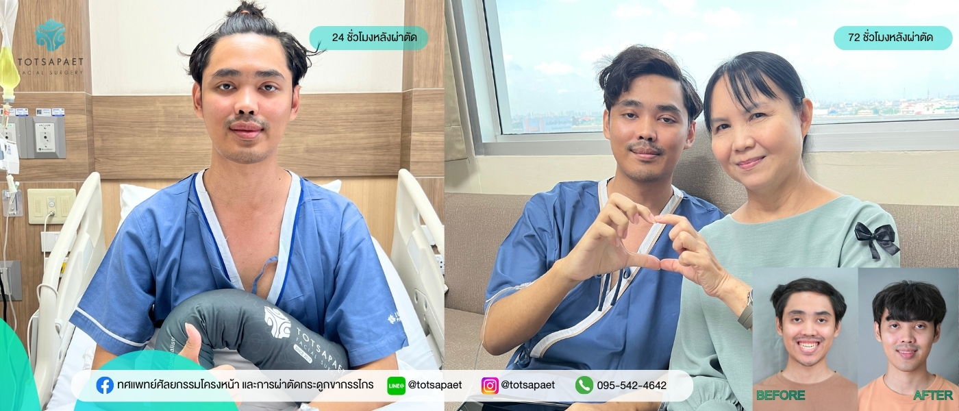 https://www.totsapaetsurgery.com/wp-content/uploads/2026/03/เวป1400x600-3.jpg