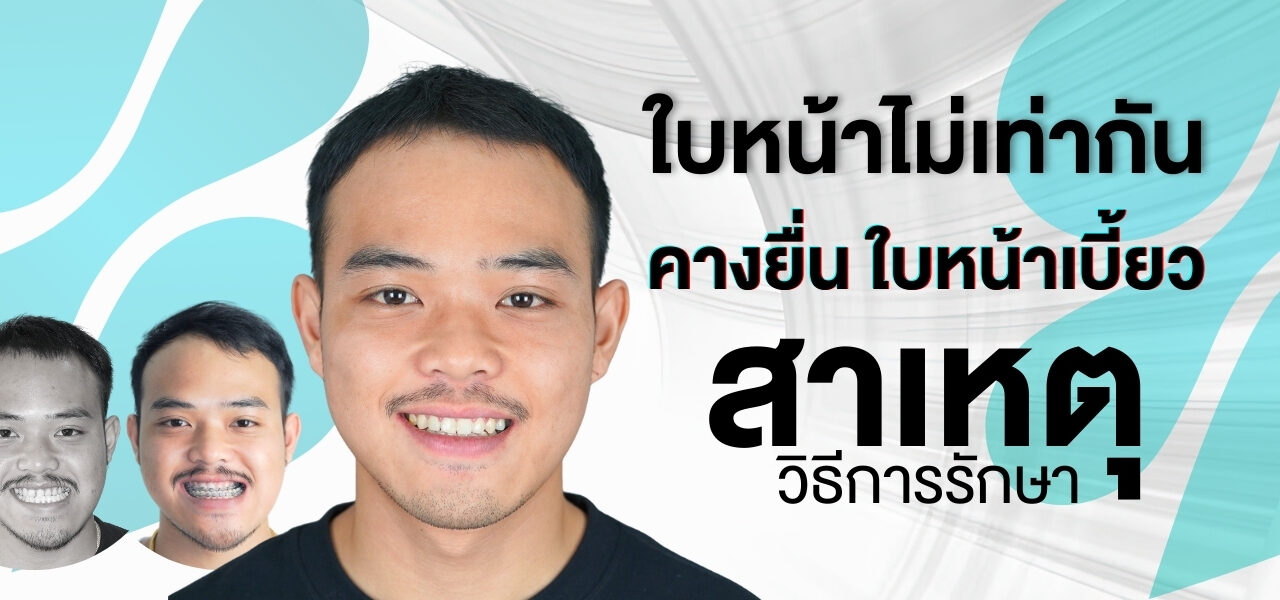 การผ่าตัดแก้ปัญหาโครงหน้ากระดูกขากรรไกร (Oral and Maxillofacial Surgery)