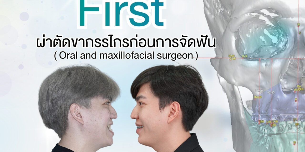 การผ่าตัดขากรรไกรร่วมกับการจัดฟัน